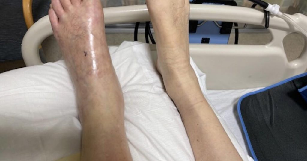 Socal Surgery was very wrong and led to a disconnection, the lawsuit says